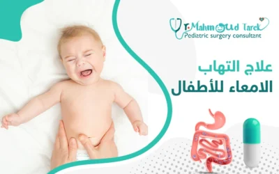 علاج التهاب الأمعاء عند الطفل الرضيع